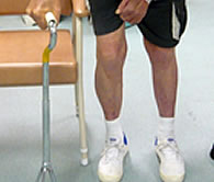 Evidence-Based Upper Limb Retraining after Stroke
